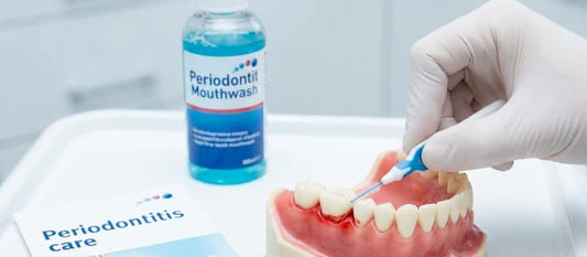 Matériel médical de démonstration pour le traitement de la parodontite avec une brosse à dents et des soins spécifiques.